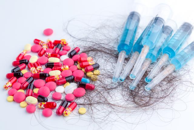 medical hair loss treatment
